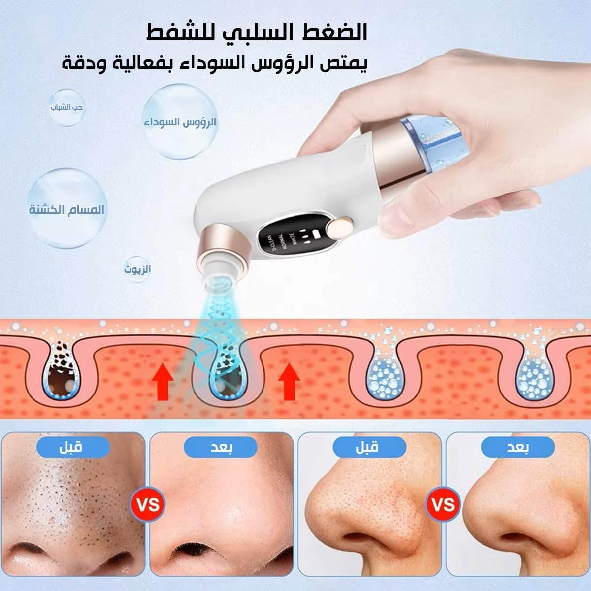 blackhead remover vacuum cleaner, Electric Facial Cleaner for Acne, Pimples, Blackheads – Water Cycle System for Deep Blackhead Removal